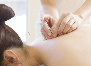 安心・安全・痛みの少ない施術